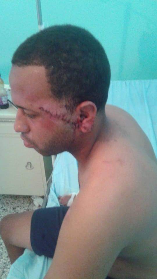 Hieren joven en Saballos Imbert