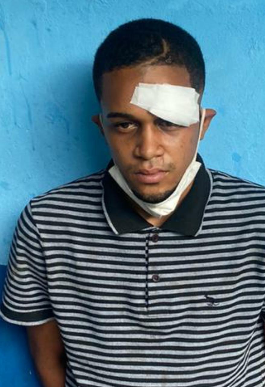 Apresan hombre en Sosúa por violencia familiar
