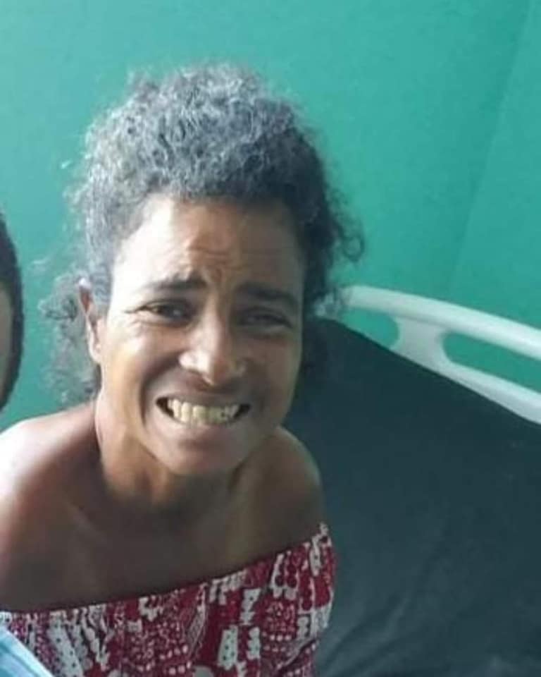 Muere enajenada mental arrollada por un vehículo en el Malecón