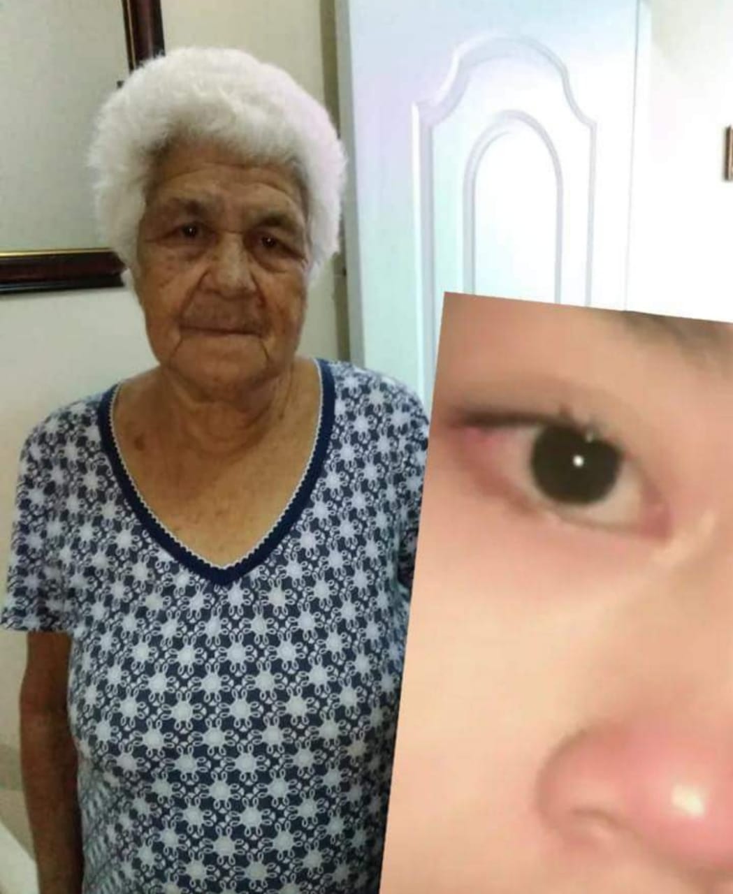 Muere señora tras ser investida por un motorista entrada de San Marcos