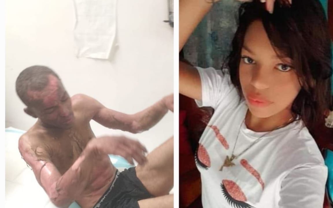 Mujer prendió fuego a hombre